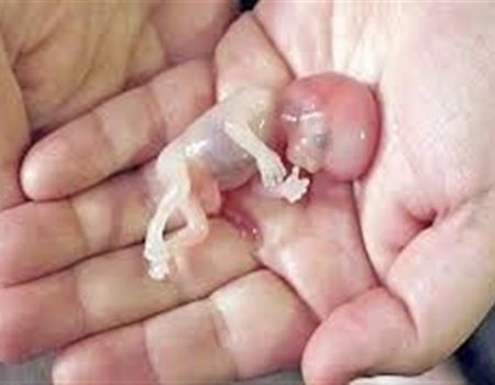 سقط جنین تنها در چارچوب قانون و با احراز شرایط مشخص مجاز است